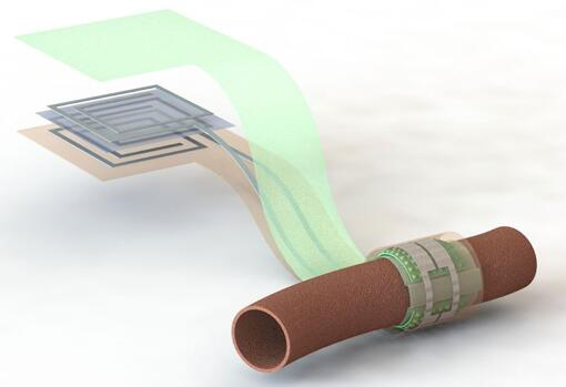 上圖描繪了這款可生物降解的壓力傳感器,它圍繞著一根血管,天線在左側(分離的層狀結構,展示了天線結構的細節) 上圖描繪了這款可生物降解的壓力傳感器,它圍繞著一根血管,天線在左側(分離的層狀結構,展示了天線結構的細節)